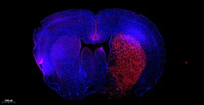 Kit di rilevamento dell'apoptosi delle cellule Tunel TMR (rosso).